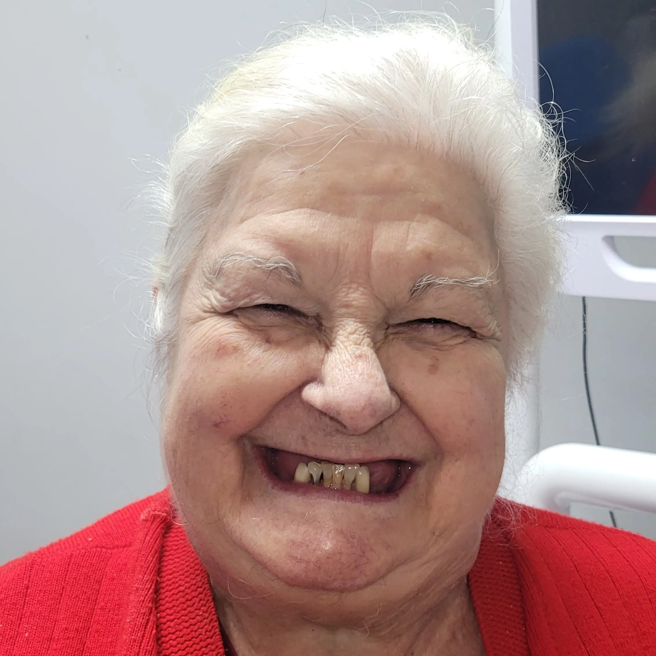 Protesis Dentales - Prótesis Dentales para Mejorar su Alimentación