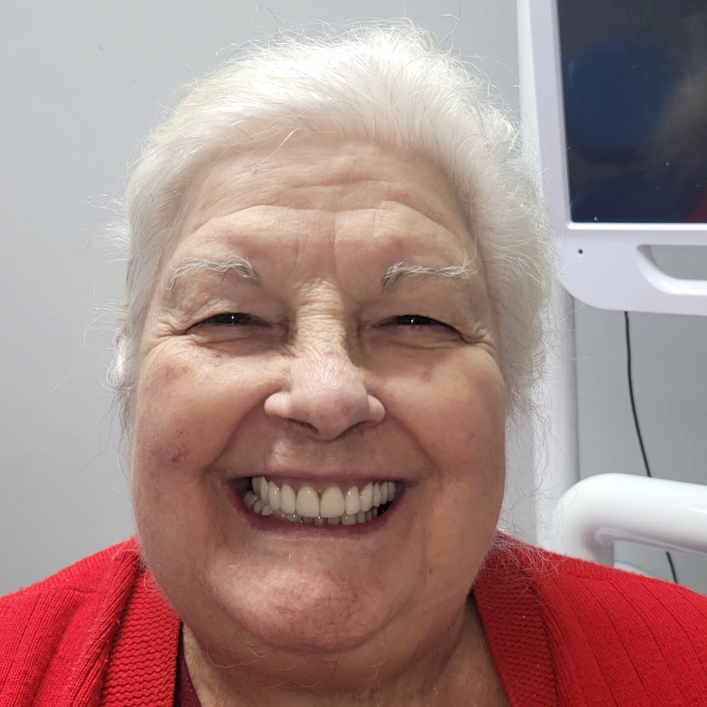 Protesis Dentales - Prótesis Dentales para Mejorar su Alimentación